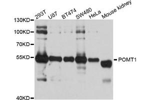 Western blot analysis of extract of various cells, using POMT1 antibody. (POMT1 Antikörper)