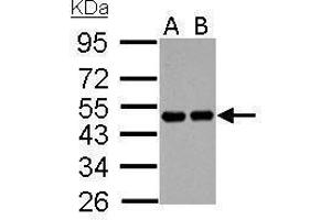 WB Image RCC1 antibody detects RCC1 protein by Western blot analysis.