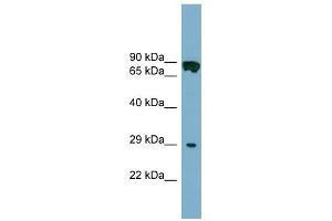 CYB5D1 antibody used at 1 ug/ml to detect target protein. (CYB5D1 Antikörper  (Middle Region))