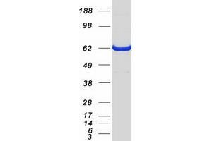 Western Blotting (WB) image for Coactivator-Associated Arginine Methyltransferase 1 (CARM1) protein (Myc-DYKDDDDK Tag) (ABIN2713182)