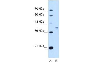 PSAT1 antibody used at 1 ug/ml to detect target protein. (PSAT1 Antikörper  (N-Term))