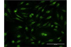 Immunofluorescence of monoclonal antibody to CSE1L on HeLa cell. (Exportin 2 Antikörper  (AA 872-971))