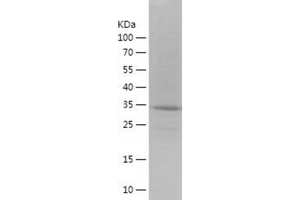 S100A11 Protein (AA 1-105) (His-IF2DI Tag)