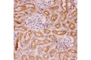 Anti-P Glycoprotein Picoband antibody,  IHC(P): Rat Kidney Tissue (ABCB1 Antikörper  (Middle Region))