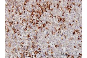 Immunoperoxidase of monoclonal antibody to APOA2 on formalin-fixed paraffin-embedded human malignant lymphoma, diffuse large B. (APOA2 Antikörper  (AA 1-100))