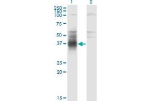Western Blot analysis of TMIGD1 expression in transfected 293T cell line by TMIGD1 monoclonal antibody (M01), clone 4A8. (TMIGD1 Antikörper  (AA 1-262))