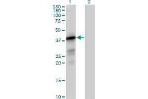 Western Blot analysis of PTPLAD1 expression in transfected 293T cell line by PTPLAD1 MaxPab polyclonal antibody.