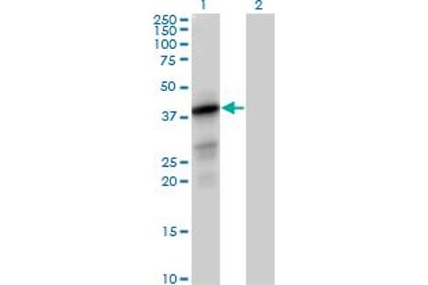 PTPLAD1 Antikörper  (AA 1-362)