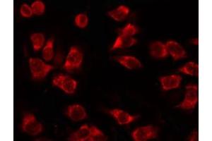 ABIN6267630 staining 293 by IF/ICC. (Acetyl-CoA Carboxylase alpha Antikörper  (pSer79))