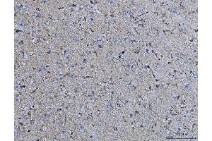 IHC analysis of COX5B using anti-COX5B antibody (ABIN7598975). (COX5B Antikörper  (AA 1-129))