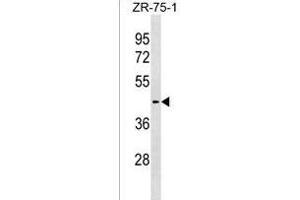 SLC30A10 Antibody (C-term) (ABIN1537148 and ABIN2838295) western blot analysis in ZR-75-1 cell line lysates (35 μg/lane). (SLC30A10 Antikörper  (AA 331-359))