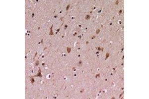 Immunohistochemical analysis of PDCD12 staining in human brain formalin fixed paraffin embedded tissue section.