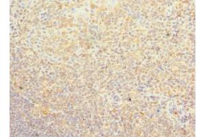 Immunohistochemistry of paraffin-embedded human tonsil tissue using ABIN7163030 at dilution of 1:100 (PSD4 Antikörper  (AA 1-300))