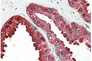 AP31101PU-N ACPP antibody staining of paraffin embedded Human Prostate at 3. (ACPP Antikörper  (Internal Region))
