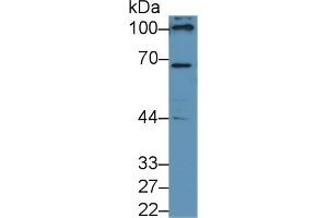Detection of NOX4 in Human 293T cell lysate using Polyclonal Antibody to NADPH Oxidase 4 (NOX4) (NADPH Oxidase 4 Antikörper  (AA 220-392))