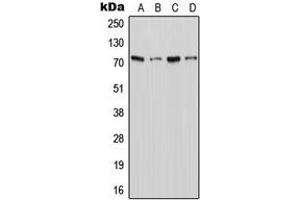 Western blot analysis of XTRP2 expression in Jurkat (A), THP1 (B), Raw264. (SLC6A18 Antikörper  (C-Term))