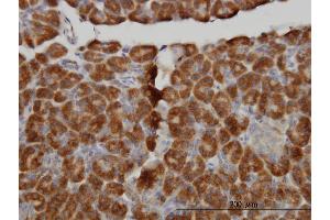 Immunoperoxidase of monoclonal antibody to MTM1 on formalin-fixed paraffin-embedded human pancreas. (MTM1 Antikörper  (AA 1-100))