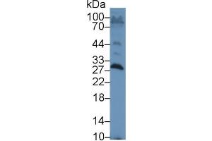 Western blot analysis of Rat Testis lysate, using Rat SAP Antibody (1 µg/ml) and HRP-conjugated Goat Anti-Rabbit antibody ( (APCS Antikörper  (AA 22-222))