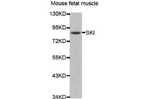 Western Blotting (WB) image for anti-SKI Proto-Oncogene (SKI) antibody (ABIN1682719) (SKI Antikörper)