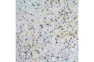 Immunohistochemical analysis of CACNG5 staining in rat brain formalin fixed paraffin embedded tissue section.