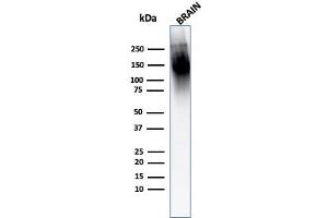 Western Blot Analysis of human Brain tissue lysate using Neurofilament Mouse Monoclonal Antibody (2F11). (NEFH & NEFL Antikörper)