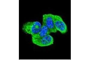 Confocal immunofluorescent analysis of HRAS Antibody (C-term) Cat. (HRAS Antikörper  (C-Term))