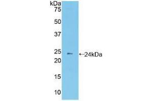 Western blot analysis of recombinant Mouse PCDHb2. (PCDHb2 Antikörper  (AA 79-253))