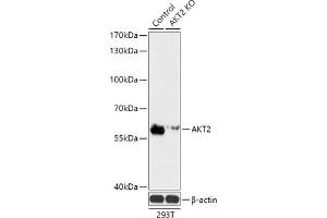 Western blot analysis of extracts from normal (control) and  knockout (KO) 293T cells, using  antibody (ABIN7271250) at 1:3000 dilution. (AKT2 Antikörper)