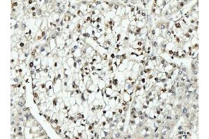 IHC analysis of PCNA using anti-PCNA antibody (ABIN7599181).
