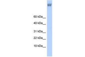 Image no. 1 for anti-Zinc Finger Protein 644 (ZNF644) (AA 1223-1272) antibody (ABIN6740620) (ZNF644 Antikörper  (AA 1223-1272))