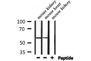 Western blot analysis of extracts from mouse kidney,mouse heart, using BACE Antibody. (BACE1 Antikörper  (C-Term))