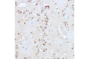 Immunohistochemistry of paraffin-embedded mouse brain using YTHDF3 Rabbit pAb (ABIN6130934, ABIN6150345, ABIN6150346 and ABIN6224441) at dilution of 1:500 (40x lens). (YTHDF3 Antikörper  (AA 1-275))