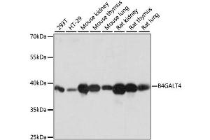 Western blot analysis of extracts of various cell lines, using B4GALT4 antibody (ABIN6291371) at 1:1000 dilution.