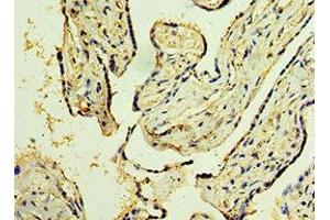 Immunohistochemistry (IHC) image for anti-Trimethylguanosine Synthase 1 (TGS1) (AA 714-853) antibody (ABIN7173394)