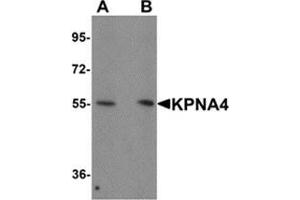 Western blot analysis of KPNA1 in Hela cell lysate with KPNA1 antibody at 1 μg/ml. (KPNA4 Antikörper  (N-Term))
