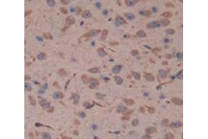 IHC-P analysis of Mouse Tissue, with DAB staining. (Fascin 2 Antikörper  (AA 308-442))