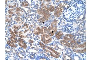 Immunohistochemistry (IHC) image for anti-CD36 (CD36) (N-Term) antibody (ABIN2783230)