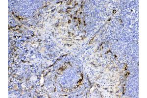 Immunohistochemistry (IHC) image for anti-Endoglin (ENG) (AA 27-226) antibody (ABIN5518982)
