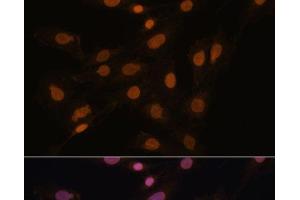 Immunofluorescence analysis of C6 cells using CBX3 Polyclonal Antibody at dilution of 1:100. (CBX3 Antikörper)