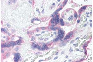Human Placenta (formalin-fixed, paraffin-embedded) stained with GRK5 antibody ABIN290254 at 20 ug/ml followed by biotinylated goat anti-rabbit IgG secondary antibody ABIN481713, alkaline phosphatase-streptavidin and chromogen. (GRK5 Antikörper  (AA 350-400))