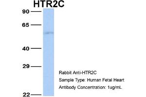 Western Blotting (WB) image for anti-5-Hydroxytryptamine (serotonin) Receptor 2C (HTR2C) (N-Term) antibody (ABIN2792274)