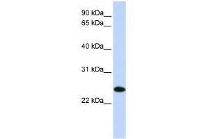 WB Suggested Anti-UBE2K Antibody Titration: 0.