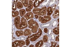 Immunohistochemical staining of human kidney with C11orf54 polyclonal antibody  shows strong cytoplasmic and nuclear positivity in cells in tubules. (C11orf54 Antikörper)