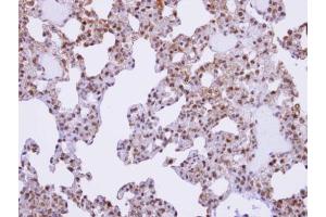 IHC-P Image Immunohistochemical analysis of paraffin-embedded human lung, using XE7, antibody at 1:100 dilution. (SFRS17A Antikörper  (C-Term))