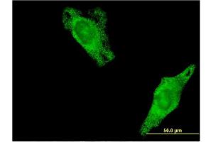 Immunofluorescence of monoclonal antibody to RALA on HeLa cell. (rala Antikörper  (pSer194))