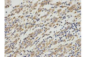 Immunohistochemistry (IHC) image for anti-Proliferation-Associated 2G4, 38kDa (PA2G4) antibody (ABIN1876564) (PA2G4 Antikörper)