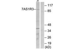 Western blot analysis of extracts from Jurkat cells, using TAS1R3 Antibody.