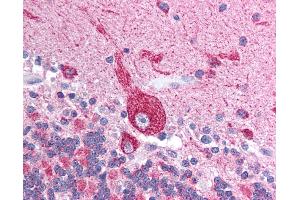 Anti-VDAC2 antibody IHC of human brain, cerebellum. (VDAC2 Antikörper  (N-Term))