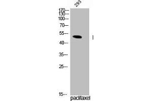 Western Blot analysis of 293 cells using Phospho-TPH1 (S58) Polyclonal Antibody (Tryptophan Hydroxylase 1 Antikörper  (pSer58))