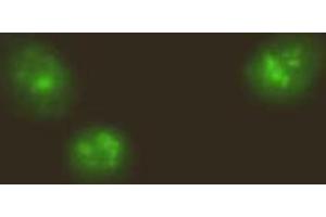 Immunofluorescencechemistry. (NF-kB p65 Antikörper  (N-Term, NLS Domain))